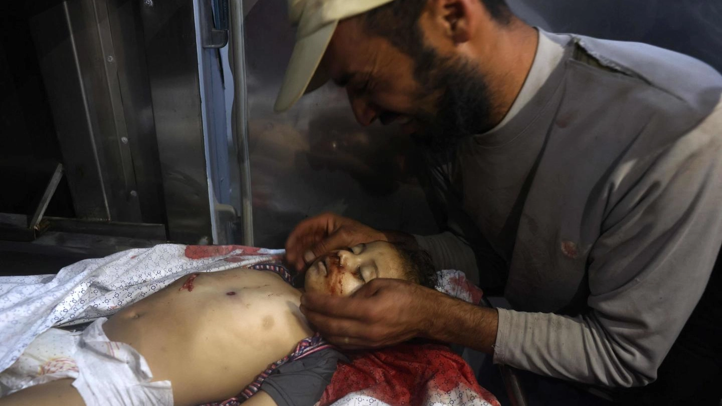 In una foto diffusa dai palestinesi, un bambino colpito a Gaza