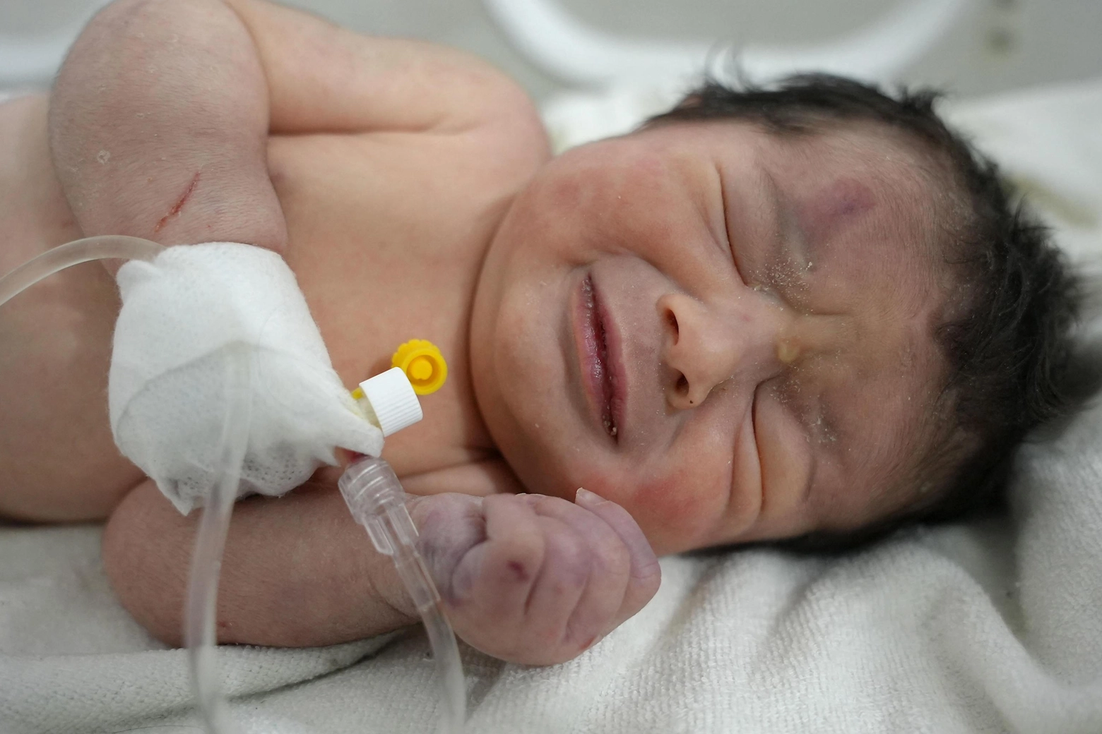 Terremoto Siria, la neonata trovata con il cordone ombelicale ancora attaccato alla madre