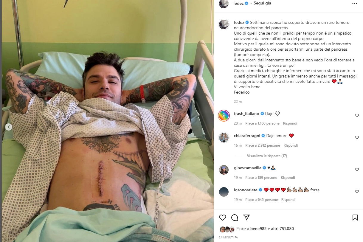 Fedez dopo l'operazione per tumore al pancreas