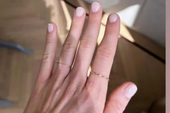 La manicure di Francesca Ferragni (Foto Instagram)
