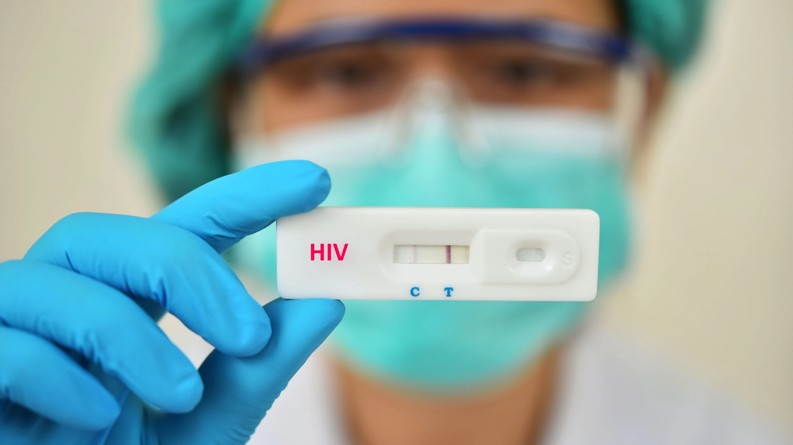 Test Hiv (Archivio)