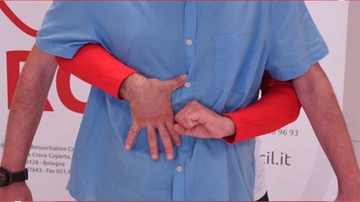 Cos'è e come si fa la manovra Heimlich: disostruzione per salvare chi sta soffocando