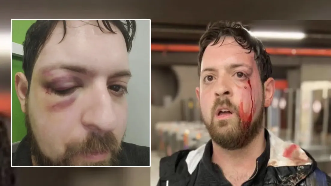 “Matthia Pezzoni circondato e aggredito nel metrò”. Il 34enne segnalava le borseggiatrici