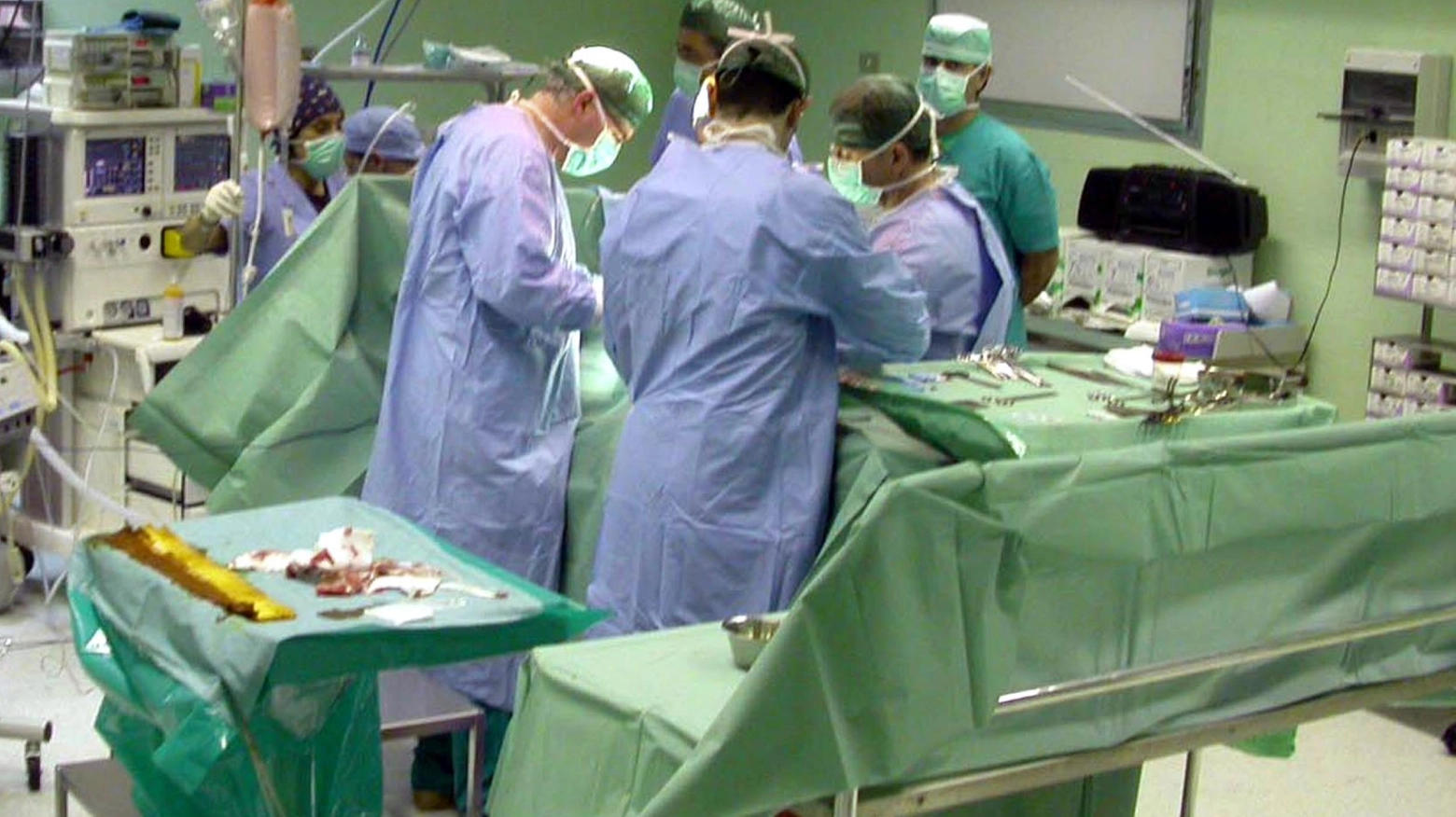 Doppio trapianto di fegato a distanza di 17 anni all'ospedale Niguarda Doppio trapianto di fegato a distanza di 17 anni all'ospedale Niguarda