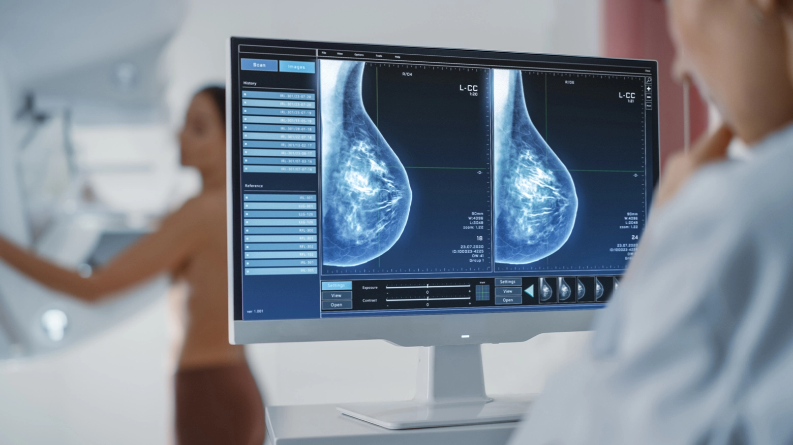 La mammografia aiuta nella prevenzione di possibili tumori al seno