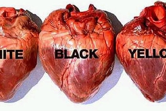 DETTAGLI “Oliviero Toscani - Più di 50 anni di magnifici fallimenti” è aperta fino al 28 aprile alla Whitelight Art Gallery, in viale Lunigiana