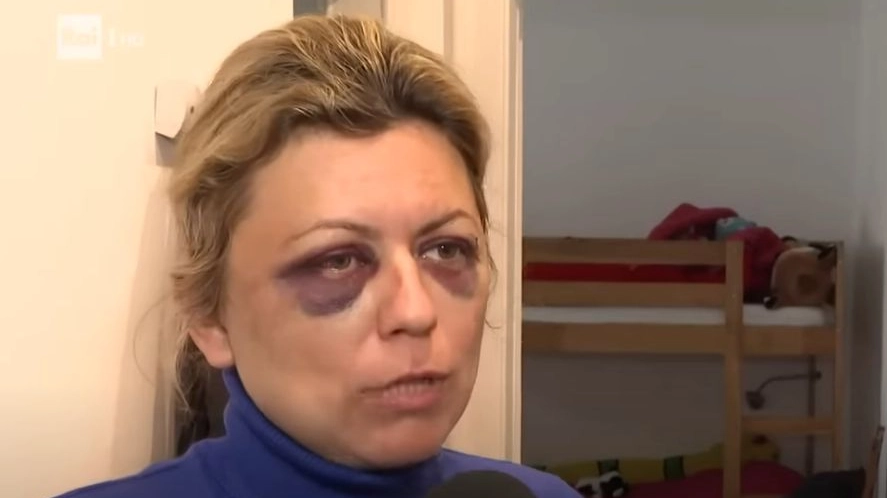 La signora vittima della brutale aggressione, che ha preferito non rivelare il suo nome La signora vittima della brutale aggressione, che ha preferito non rivelare il suo nome
