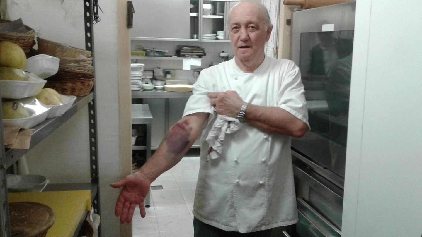 Mario Cattaneo mostra il livido sulle braccia dopo la colluttazione (Ansa)