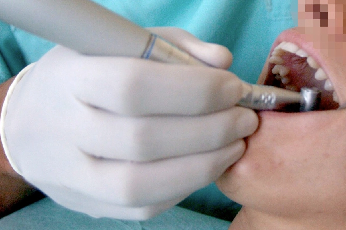 Un dentista (Foto di repertorio)