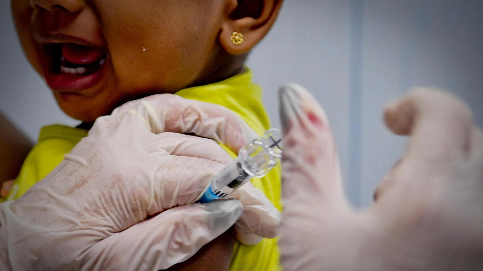 Morbillo, vaccinazioni: foto generica (Ansa)