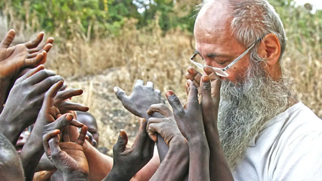 Ferito da una mina in Africa  "Se sono ancora in vita  è perché servo a qualcosa"