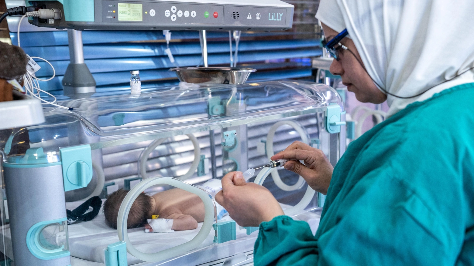 Un bimbo nel reparto di patologia neonatale Un bimbo nel reparto di patologia neonatale