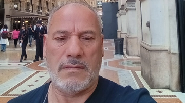 Milano, tumore di 8 centimetri scambiato per sinusite. “Io, miracolato”