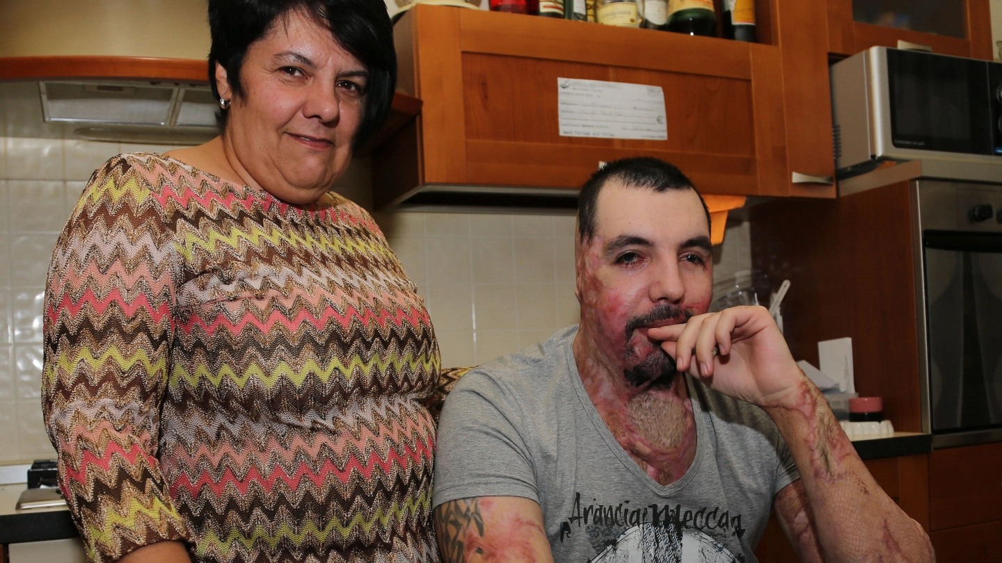 Fiorella Pezzulo con il figlio William, sfregiato con l’acido dall’ex fidanzata Elena Perotti insieme a un complice 