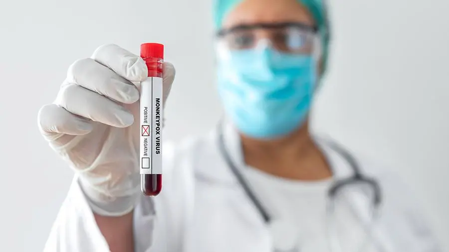 Vaiolo delle scimmie, in Lombardia arrivano altri vaccini: quando e come prenotare