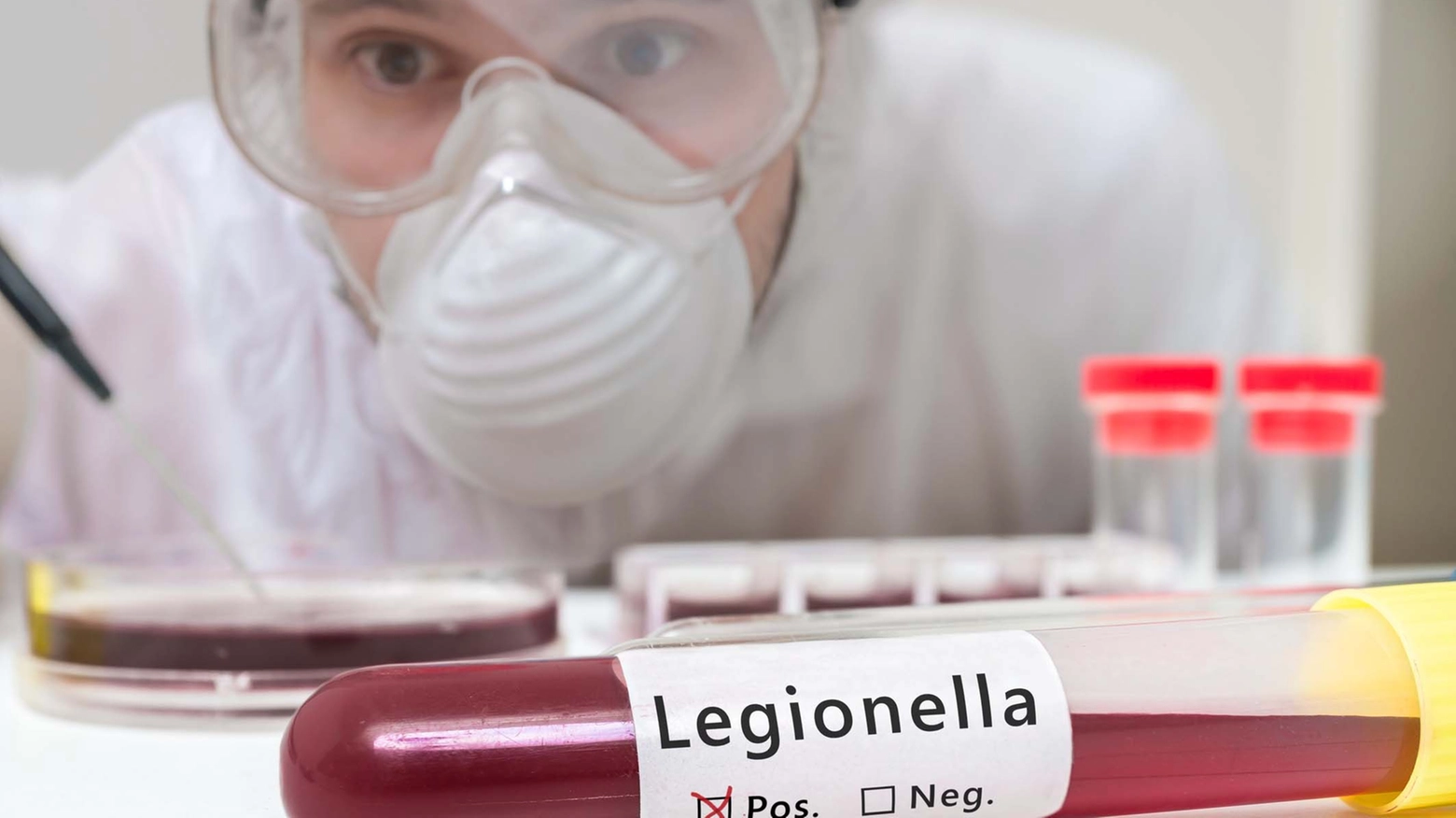Legionella (foto repertorio)
