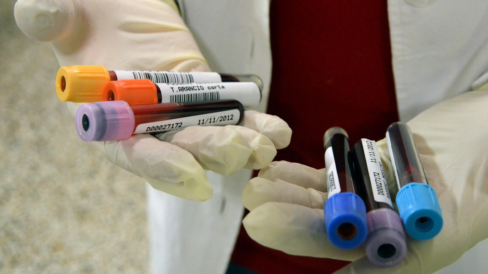 Le donazioni di sangue sono in calo in Lombardia, non i donatori Le donazioni di sangue sono in calo in Lombardia, non i donatori