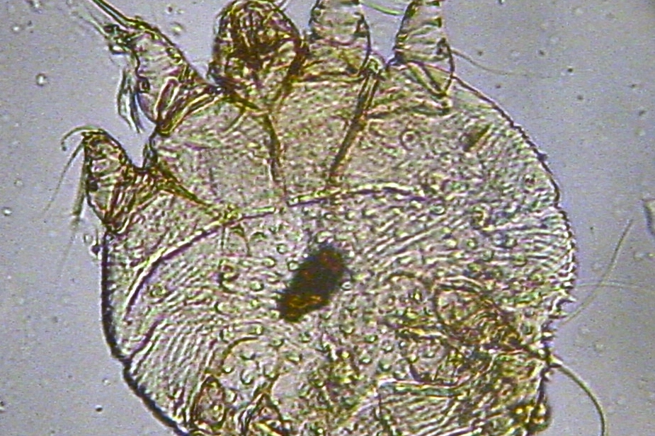 L'acaro della scabbia