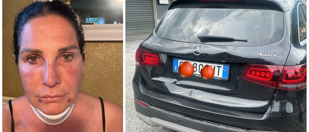 Lara Magoni, incidente stradale a Endine: “È andato tutto bene, ma non si fa così. Non si scappa”