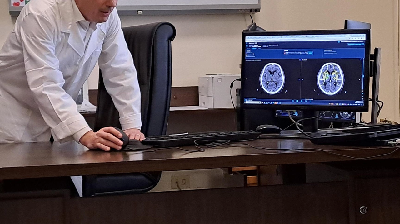 Nuovo software donato da Soleto all'Asst Melegnano Martesana per diagnosi e cura ictus. Identifica penombra ischemica per interventi mirati entro poche ore dai sintomi. Nuovo software donato da Soleto all'Asst Melegnano Martesana per diagnosi e cura ictus. Identifica penombra ischemica per interventi mirati entro poche ore dai sintomi.