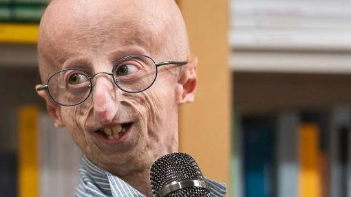 Sammy Basso, biologo e attivista, è morto il 5 ottobre 2024 a 28 anni Sammy Basso, biologo e attivista, è morto il 5 ottobre 2024 a 28 anni