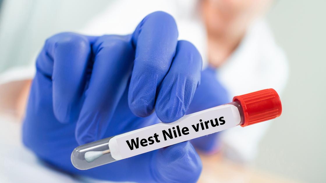 Il West Nile in Lombardia, il punto sui casi ma nel 2023 era andata peggio. Quali sono gli altri virus “esotici” Il West Nile in Lombardia, il punto sui casi ma nel 2023 era andata peggio. Quali sono gli altri virus “esotici”