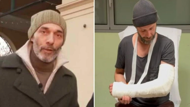 Max Laudadio, inviato di Strsicia la Notizia (frame video) e il cameraman con il gesso al braccio dopo un'aggressione durante un servizio Max Laudadio, inviato di Strsicia la Notizia (frame video) e il cameraman con il gesso al braccio dopo un'aggressione durante un servizio