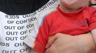 Si definisce malattia rara una patologia che colpisce una persona su duemila. Si definisce malattia rara una patologia che colpisce una persona su duemila.