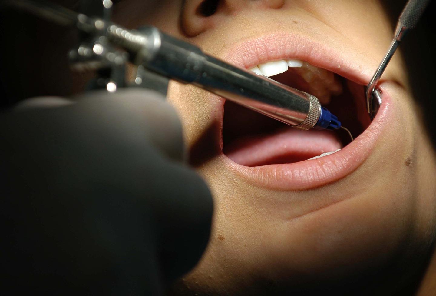 vigevano facevano i dentisti ma non avevano la laurea denunciati