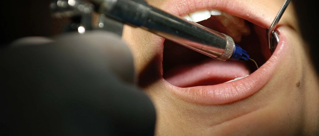 Vigevano, facevano i dentisti ma non avevano la laurea: denunciati