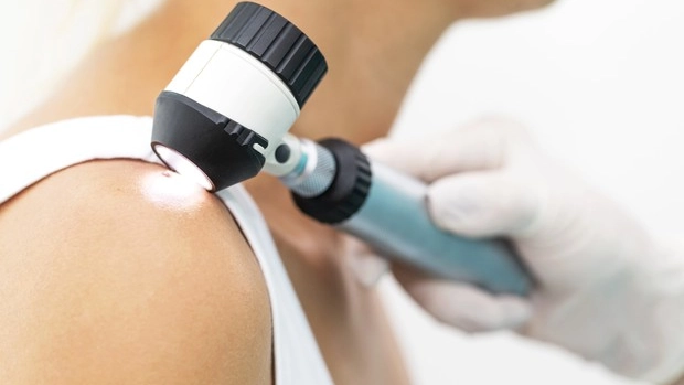 Melanoma, un controllo clinico (foto repertorio Ansa)