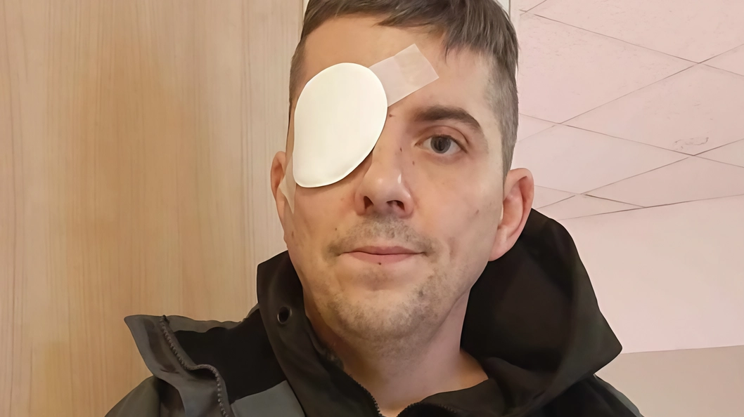 Gabriele Granata ha perso un occhio dopo essere stato aggredito da una banda di ragazzini