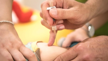 Morbillo, boom di infezioni in Europa: casi aumentati di 60 volte nel 2023. L’Oms: “Quasi 2 milioni di bambini non vaccinati in tre anni”