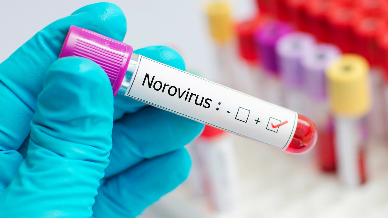 Norovirus Norovirus