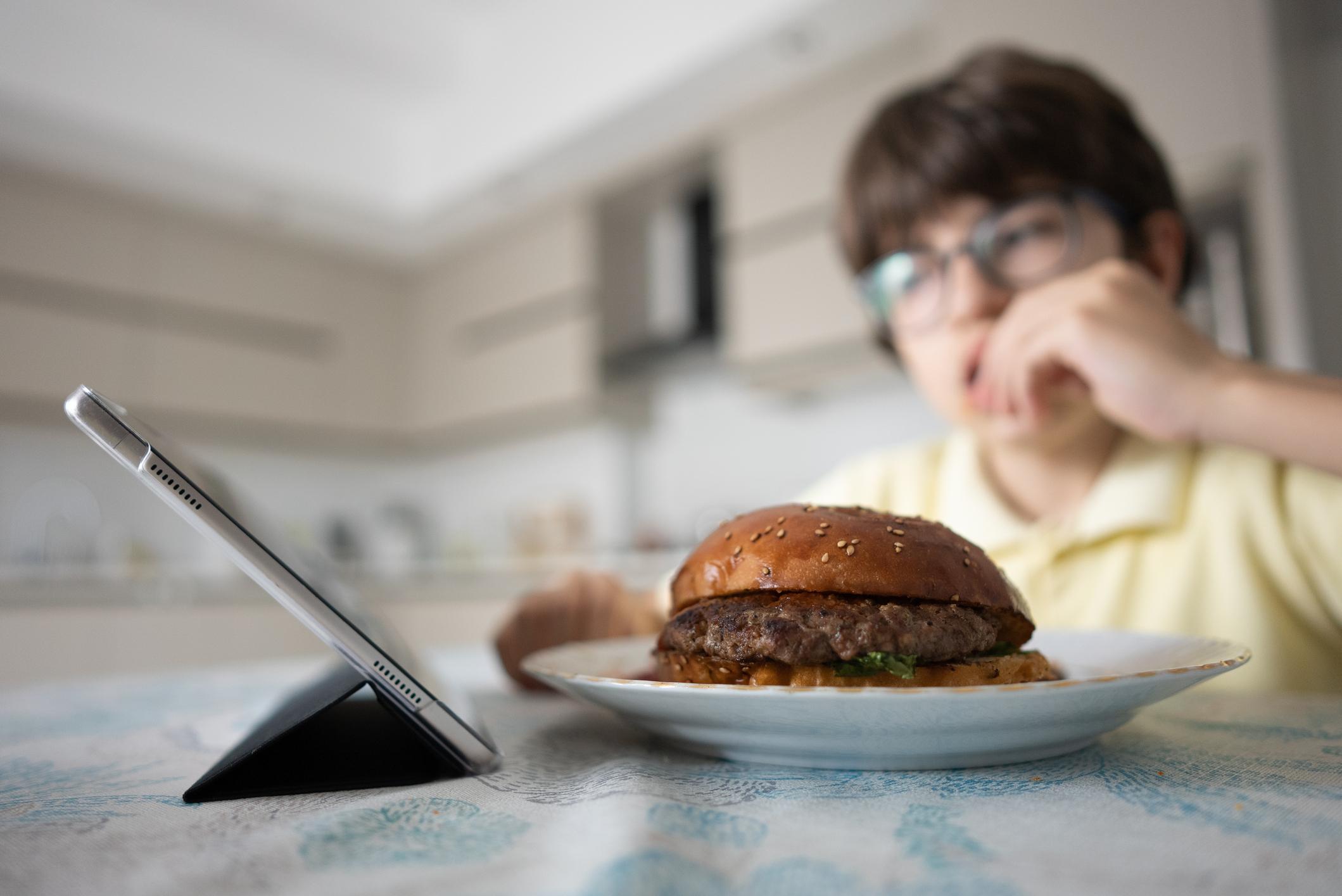 La sfida all’obesità dell’Humanitas: combattere (e gestire) una condizione sempre più diffusa