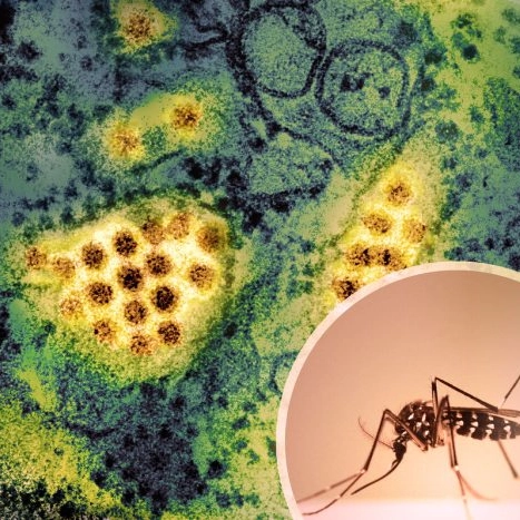 Caso di Dengue a Monza