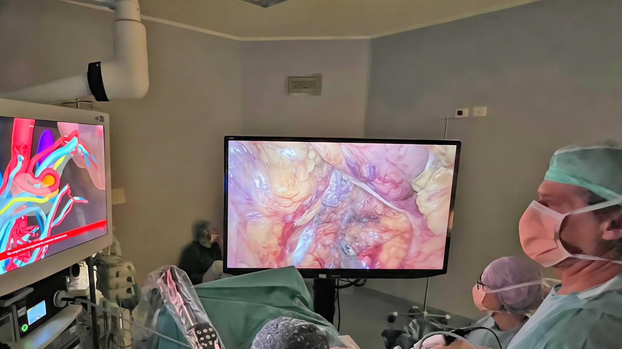 Le nuove tecnologie al servizio della medicina: un delicato intervento in chirurgia mininvasiva al pancreas è stato eseguito nei...