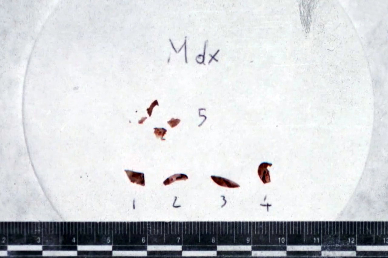 Alcune tracce di Dna ritrovate sotto le unghie di Chiara Poggi