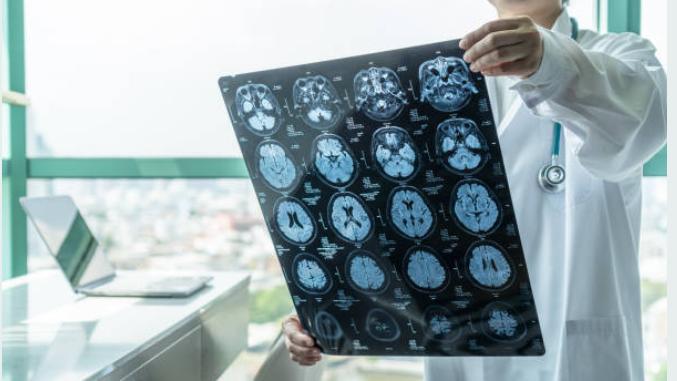 la prevenzione di ictus e fibrillazione atriale comincia a tavola   i menu degli chef e i consigli dei cardiologi