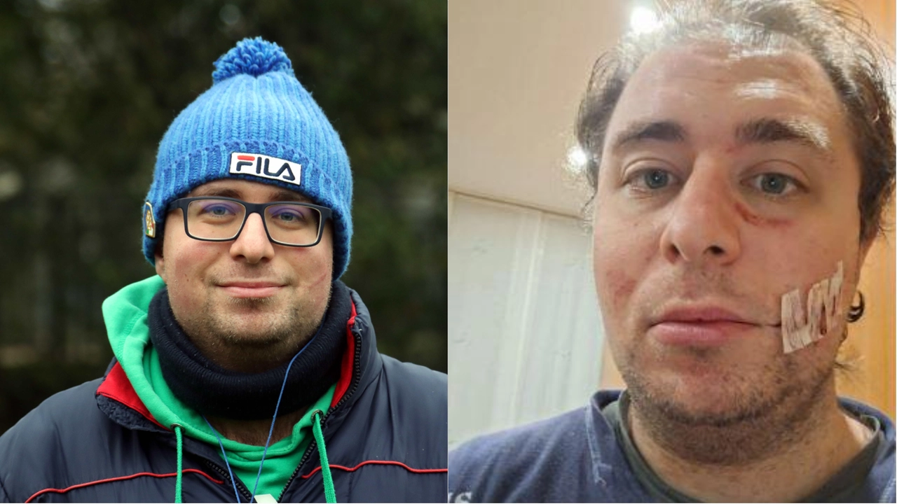 Alessandro Anaclerio oggi e poco dopo l’aggressione Alessandro Anaclerio oggi e poco dopo l’aggressione