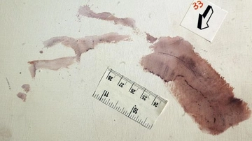 La linea di Stasi e le tracce contro Sempio: il sangue, l’intonaco e il piede “femminile”. L’assist del ministro Nordio: “Condanna irragionevole”