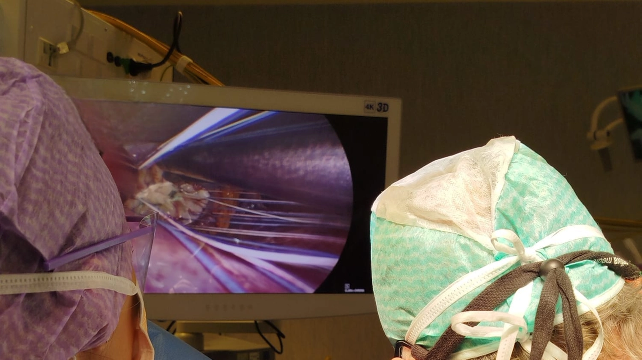 Alla cardiochirurgia di Legnano una nuova tecnica per sostituire la valvola aortica Alla cardiochirurgia di Legnano una nuova tecnica per sostituire la valvola aortica