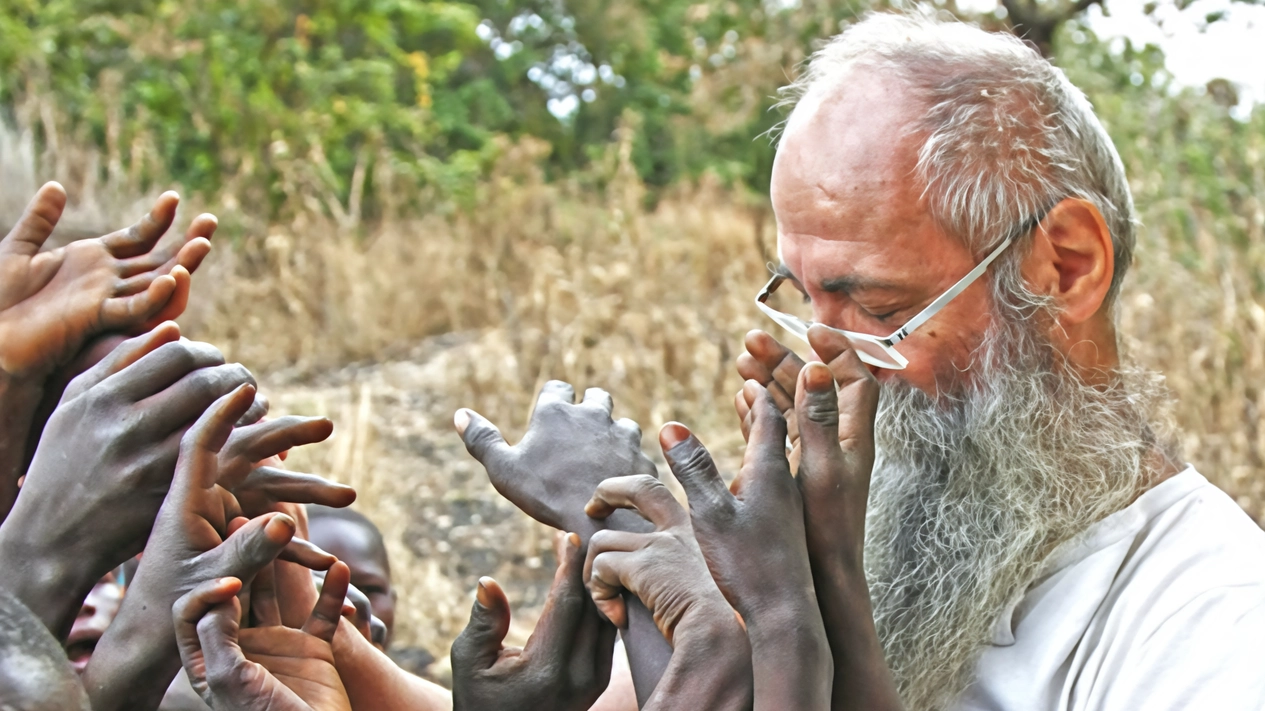 Padre Norberto è rimasto ferito in Africa a una gamba per lo scoppio di una mina ma vuole ritornare Padre Norberto è rimasto ferito in Africa a una gamba per lo scoppio di una mina ma vuole ritornare