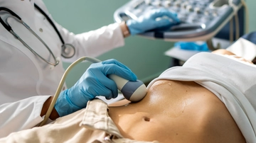Tumore al fegato, casi in aumento entro il 2040. “Nuove speranze dall’immonoterapia”