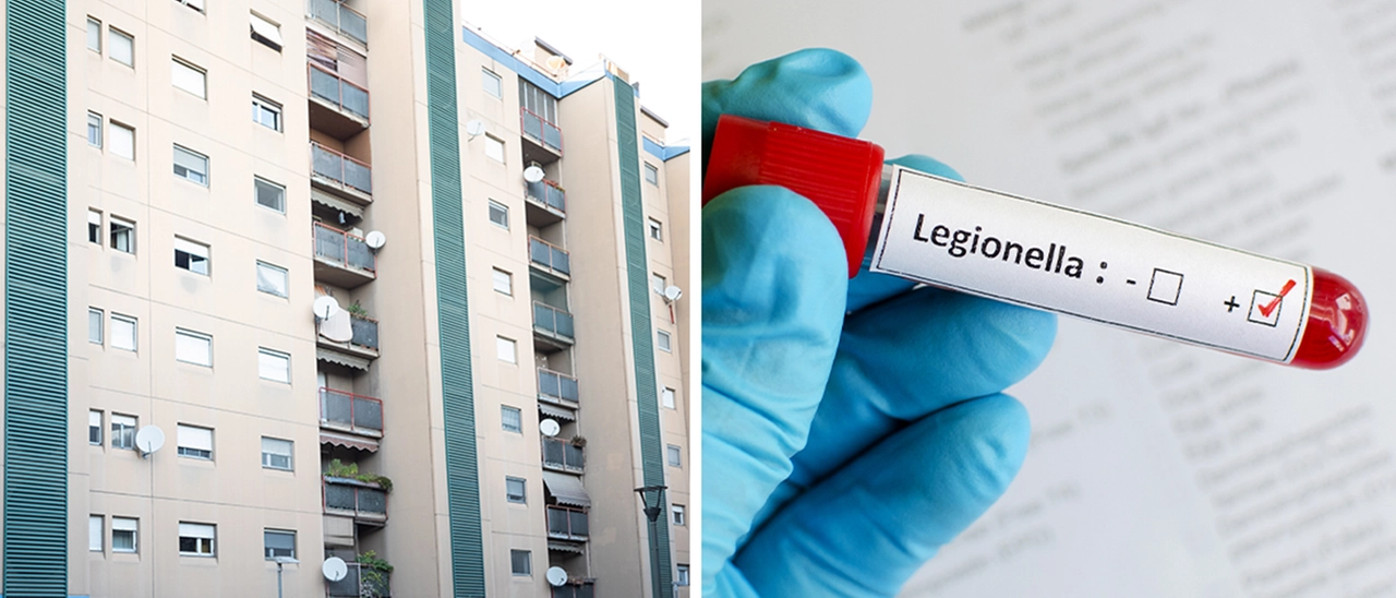 Legionella a Milano, salgono a 7 i casi in via Rizzoli: il rebus dell’origine del focolaio