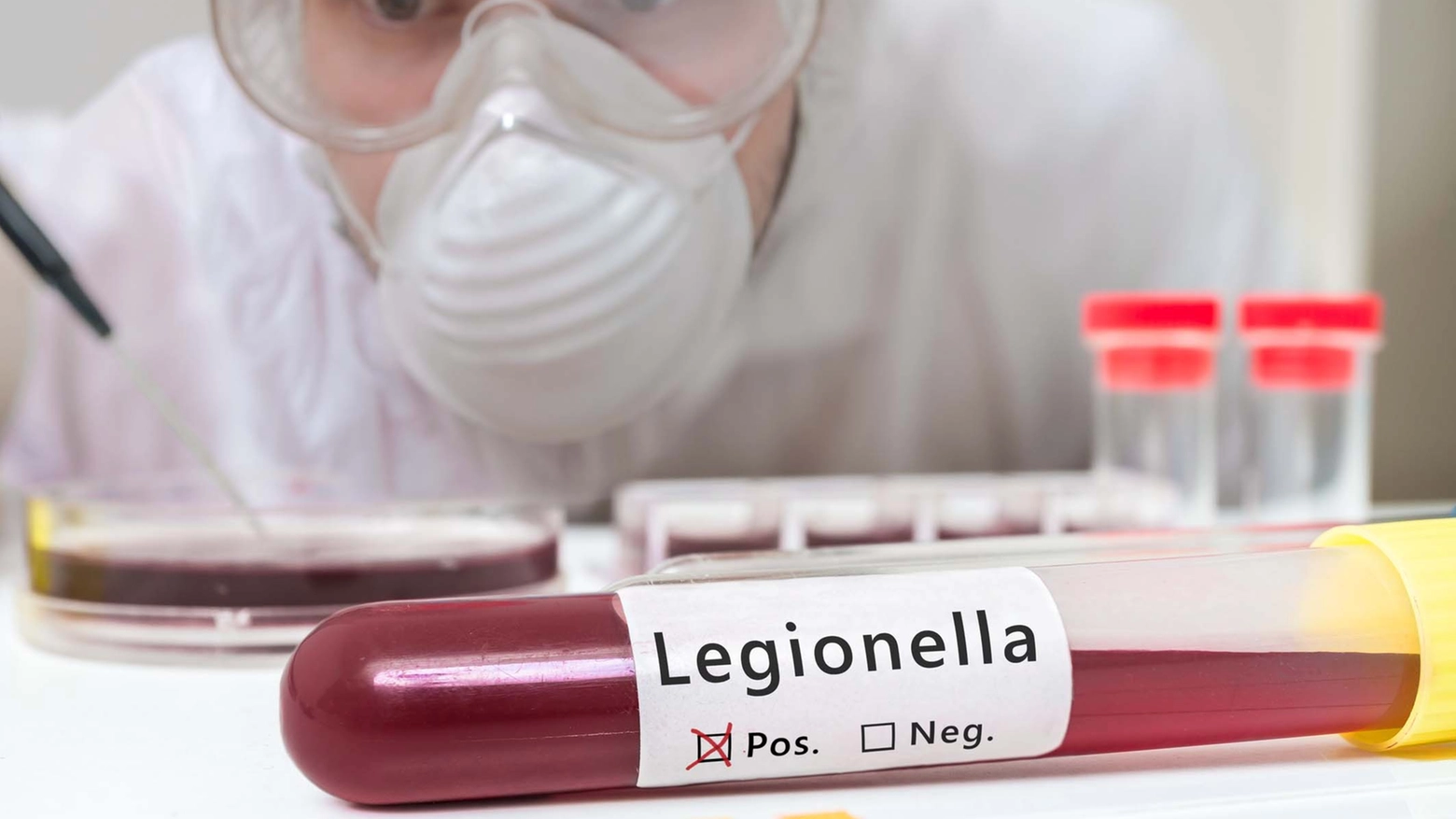 Legionella (foto repertorio)