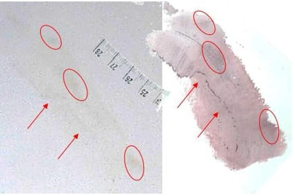 L'analisi dell'impronta 33 nella consulenza di parte della famiglia di Chiara Poggi