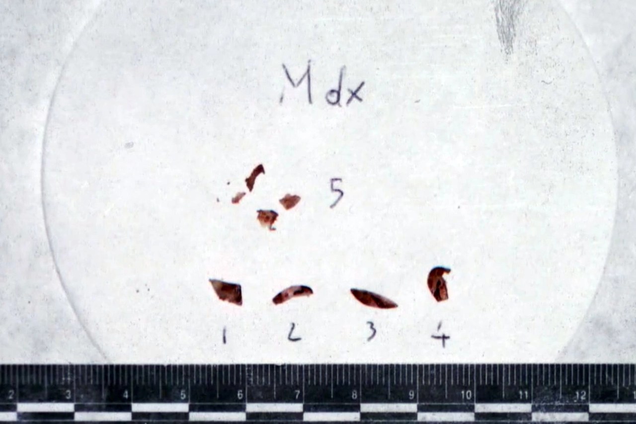 Alcune tracce di Dna ritrovate sotto le unghie di Chiara Poggi