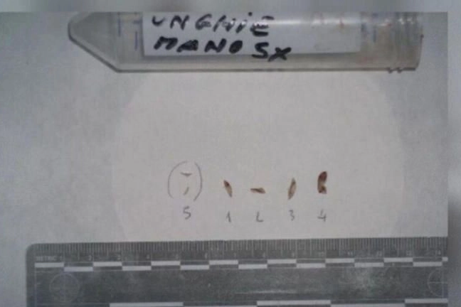 UNGHIE