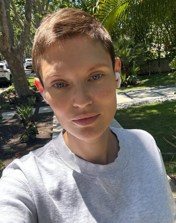 Bianca Balti e il tumore ovarico: “Una campagna di ricerca che sta cambiando la vita delle donne. Farne parte è un onore”